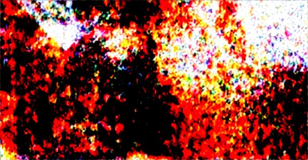 Épilation laser pour peaux foncées : découvrez la sécurité et l'efficacité